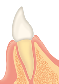 通常の前歯